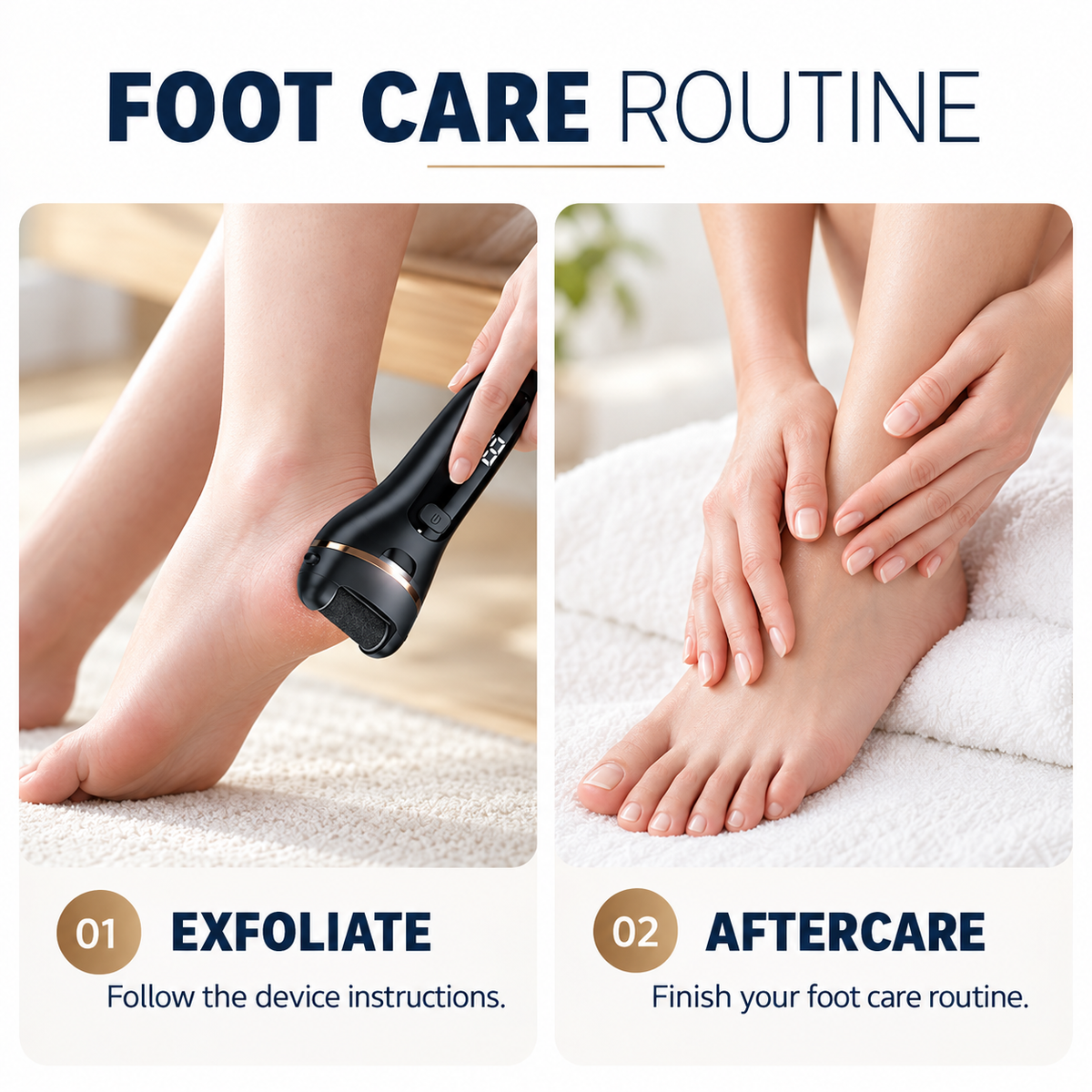 SoftStep Electric Foot File – Rechargeable Callus Remover for Smooth Feet